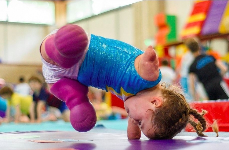 Bé gái mất tứ chi khiến cả thế giới ngả mũ khâm phục be gai mat tu chi khien ca the gioi nga mu kham phuc