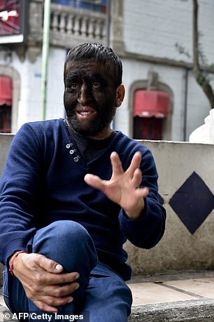 16 tre em bi hoa thanh nguoi soi vi ngo doc thuoc tri rung toc