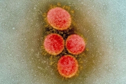 phat hien chung sars cov 2 dot bien o philippines