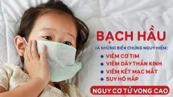 thu tuong yeu cau khong de lay lan bung phat benh bach hau