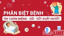 [Infographic] Phân biệt sốt xuất huyết, tay chân miệng và sởi