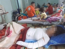 Giận chồng, vợ đang mang thai 37 tuần đổ xăng lên người tự đốt mình