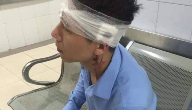 tai xe taxi vic cam hung khi hanh hung nguoi khac trong thuong