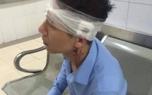 tai xe taxi vic cam hung khi hanh hung nguoi khac trong thuong