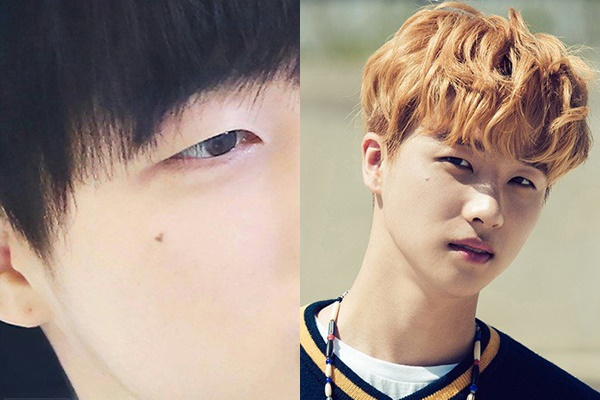 nhung not ruoi xau lai tro thanh nhung diem thu hut la ky tren khuon mat idol kpop