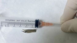 Nhập viện cấp cứu vì nuốt phải ngòi bút máy