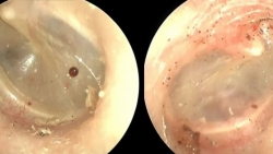 dau tai keo dai do bo cho song ky sinh