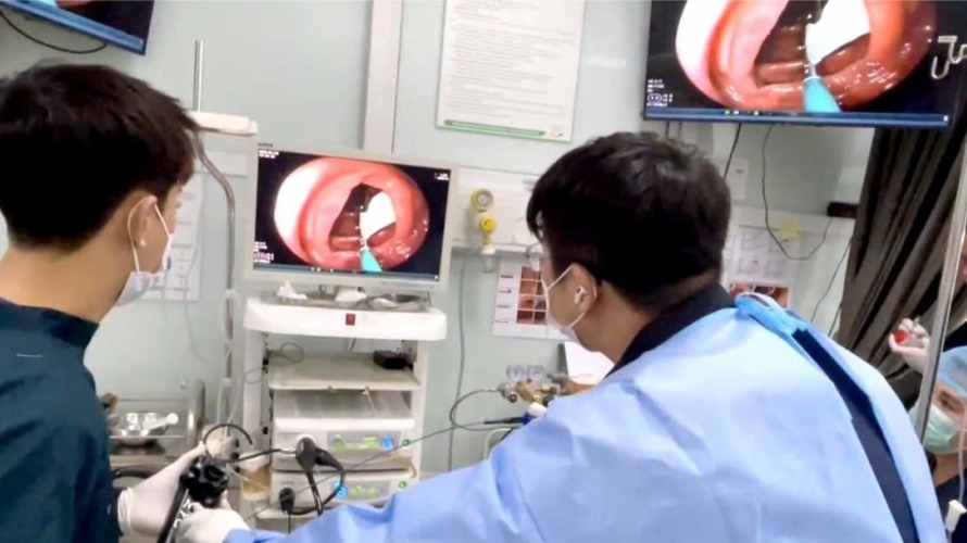 Sán dây dài 1 mét trong đại tràng bệnh nhân thích ăn đồ tái