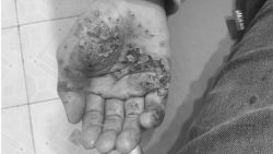 bong nang do dien thoai phat no khi vua sac vua su dung