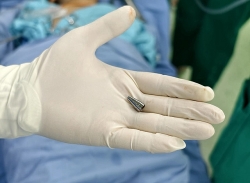 ngam dau but trong luc hoc tap be trai bi di vat roi vao duong tho