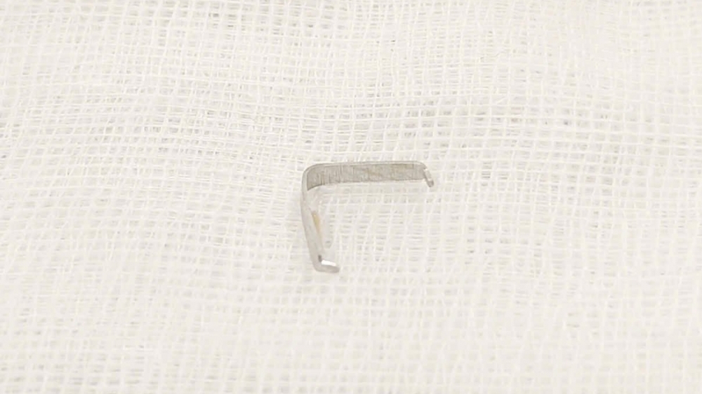 Bé 12 tháng tuổi bị hóc ghim tất vào họng