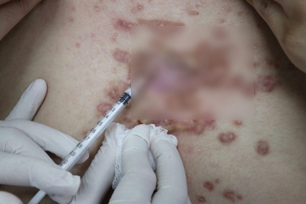 Ảnh minh họa Ảnh minh họa