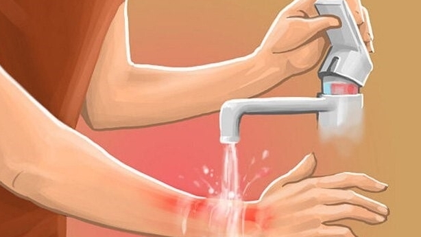 Nghịch vòi nước nóng lạnh, bé gái bỏng nặng