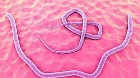 Bệnh nhân thủng ruột non do giun đũa