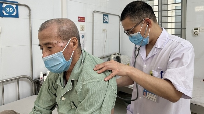 Ho suốt 3 tháng vì mắc hạt hồng xiêm trong phế quản