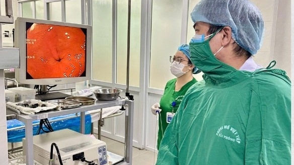 Cấp cứu vì nuốt bàn chải đánh răng dài 17cm