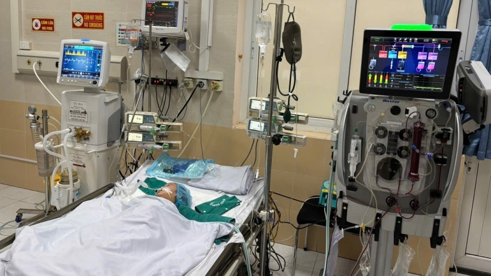 Bé gái nguy kịch do gặp biến chứng chân tay miệng