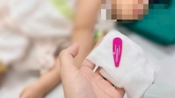 gap kep toc sac nhon trong da day be gai