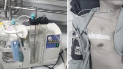 Đẩy tạ quá sức, nam bệnh nhân nhập viện cấp cứu