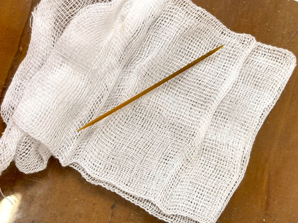 Cây tăm tre xỉa răng được lấy ra khỏi ruột già của bệnh nhân (Ảnh: BV cung cấp)