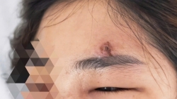 nan mun bang tay nguoi phu nu phai di cap cuu