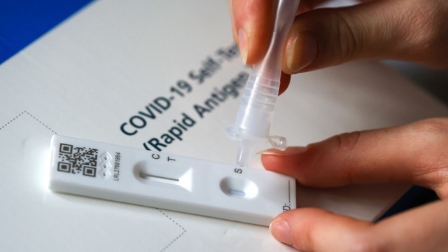 Hà Nội: Số ca tay chân miệng tăng, sởi và COVID-19 giảm nhẹ