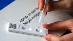 Hà Nội: Số ca tay chân miệng tăng, sởi và COVID-19 giảm nhẹ