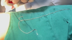 Nam thanh niên mắc “giun rồng” ngứa khắp người