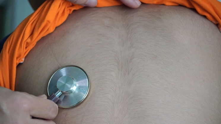 Tự mua thuốc cho con uống khiến người bé mọc đầy lông