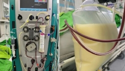 Người gầy cũng có thể bị mỡ máu cao