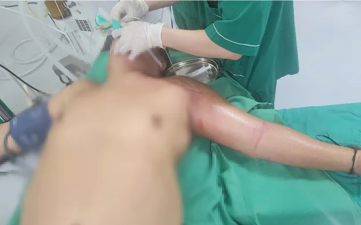 Bệnh nhân bị hoại tử cánh tay do tiêm mật gấu