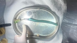 nguoi phu nu nuot phai ban chai khi dang danh rang