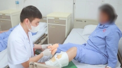 suyt phai cat bo chan vi tu xu ly mun nho tai nha