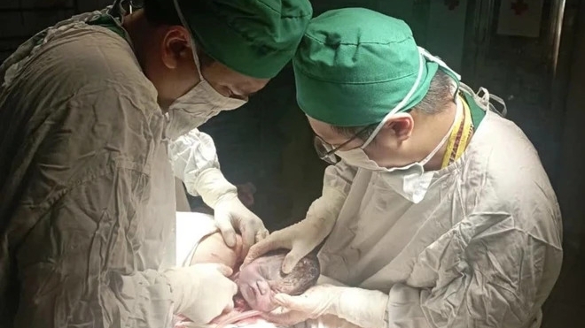 Cứu thành công thai phụ bị suy tim thai giữa tâm bão Yagi