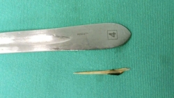 Hy hữu bệnh nhân bị xương cá dài 4cm đâm thủng ruột non gây viêm ổ bụng nặng