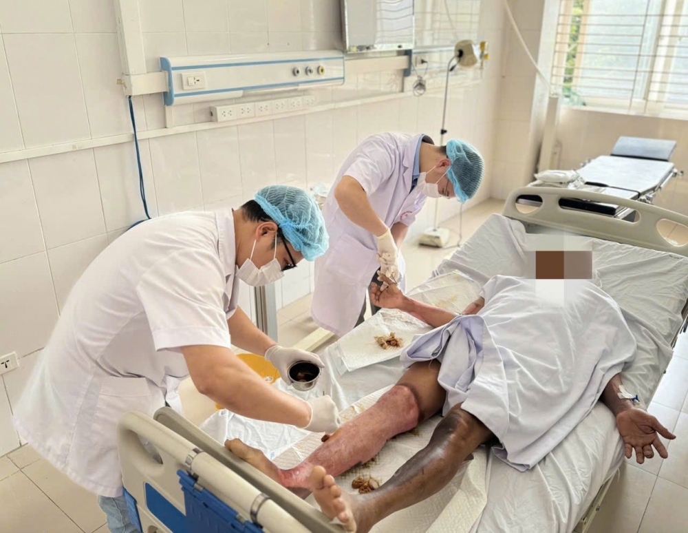 Bác sĩ chăn sóc vết bỏng cho bệnh nhân Bác sĩ chăn sóc vết bỏng cho bệnh nhân