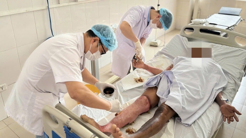 Người đàn ông bị bỏng nặng do tia hồ quang