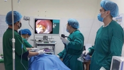 Gắp khối bã thức ăn mắc trong thực quản cho cụ bà 87 tuổi