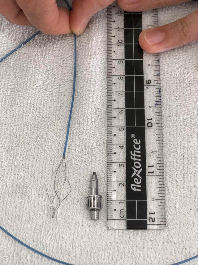 dụng cụ nha khoa bằng kim loại dài 2,5 cm – nghi rơi vào đường thở trong khi làm răng Implant