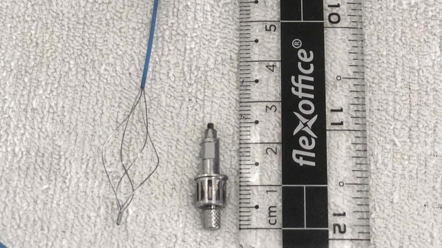 Dụng cụ nha khoa nghi rơi vào đường thở bệnh nhân khi làm răng