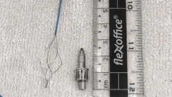 dung cu nha khoa nghi roi vao duong tho benh nhan khi lam rang