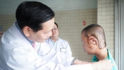 boc tach khoi u soi than kinh khong lo hiem gap tren mat