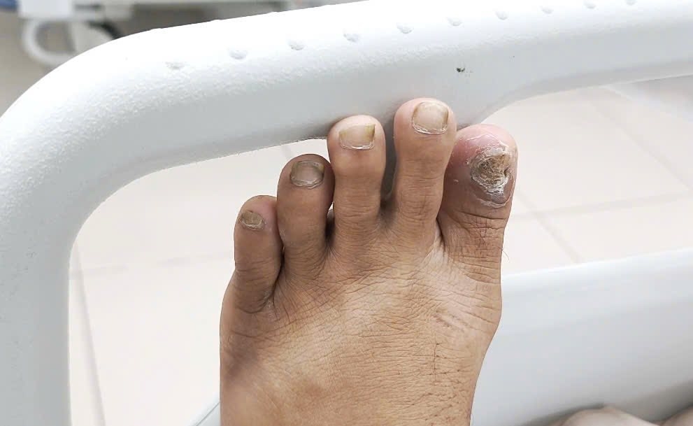 Đừng chủ quan từ những vết thương tưởng chừng vô hại