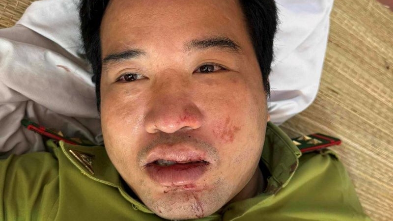 Thanh Hoá: Trạm trưởng kiểm lâm nghi bị xe chở lâm sản trái phép tông trọng thương