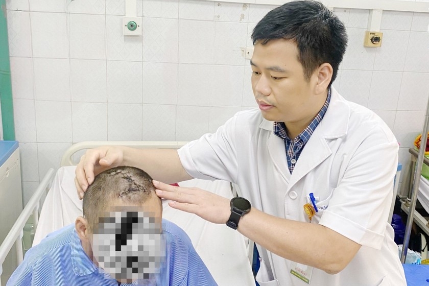Thanh Hoá: Người đàn ông trầm cảm tự đóng đinh sắt vào đầu