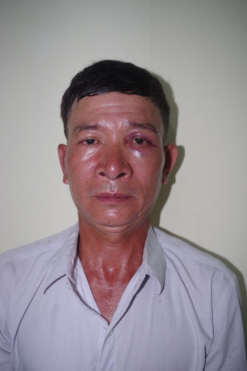 Thanh Hoá: Ngang nhiên vào bãi xe của bệnh viện để lừa đảo