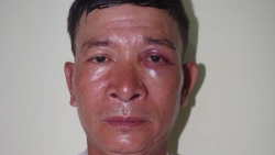 Thanh Hoá: Ngang nhiên vào bãi xe của bệnh viện để lừa đảo