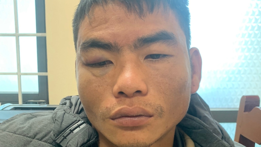 Thanh Hoá: Đột nhập vào nhà vườn trộm hàng loạt cây cảnh giá trị cao