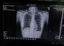 Hà Nội: Nghiên cứu sinh từ Vũ Hán về nghi nhiễm virus corona