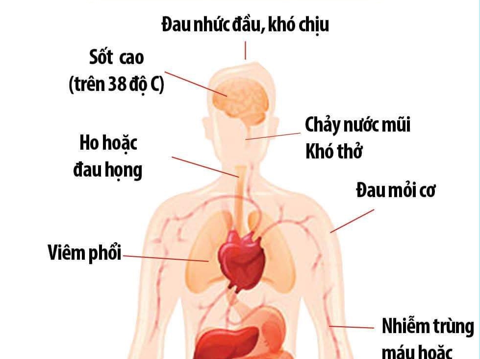 nghi ngo nhiem virus corona phai lam gi